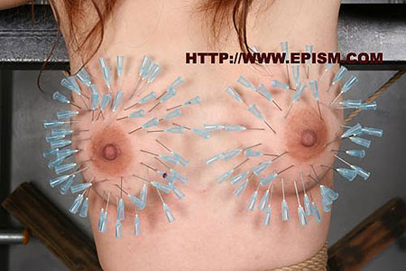 乳房の針化粧